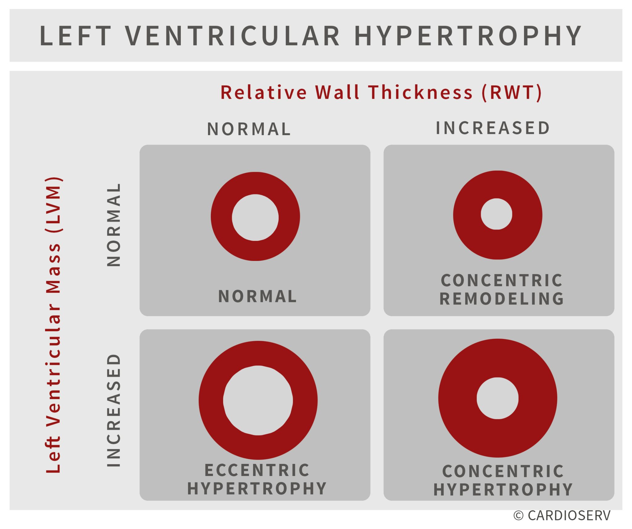 Understanding LVH Part 2: How to Measure LV Mass and Diagnose LVH ...