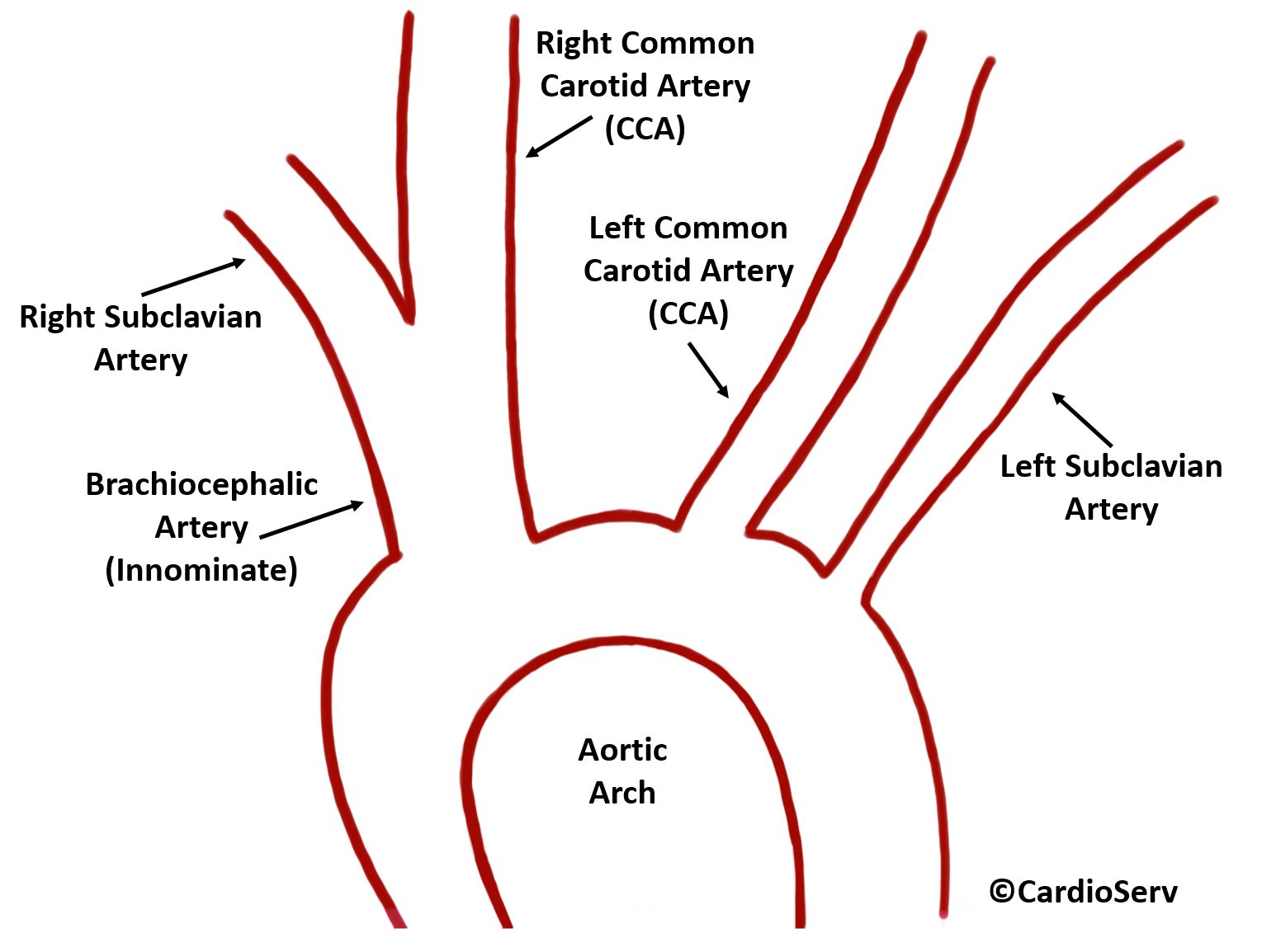 brachiocephalic artery