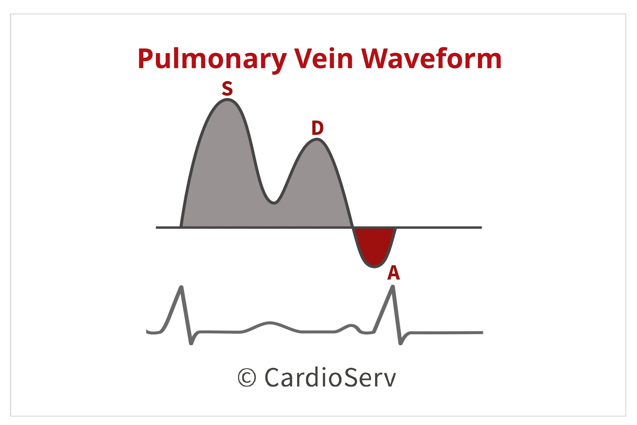 Pulmonary Venous Flow