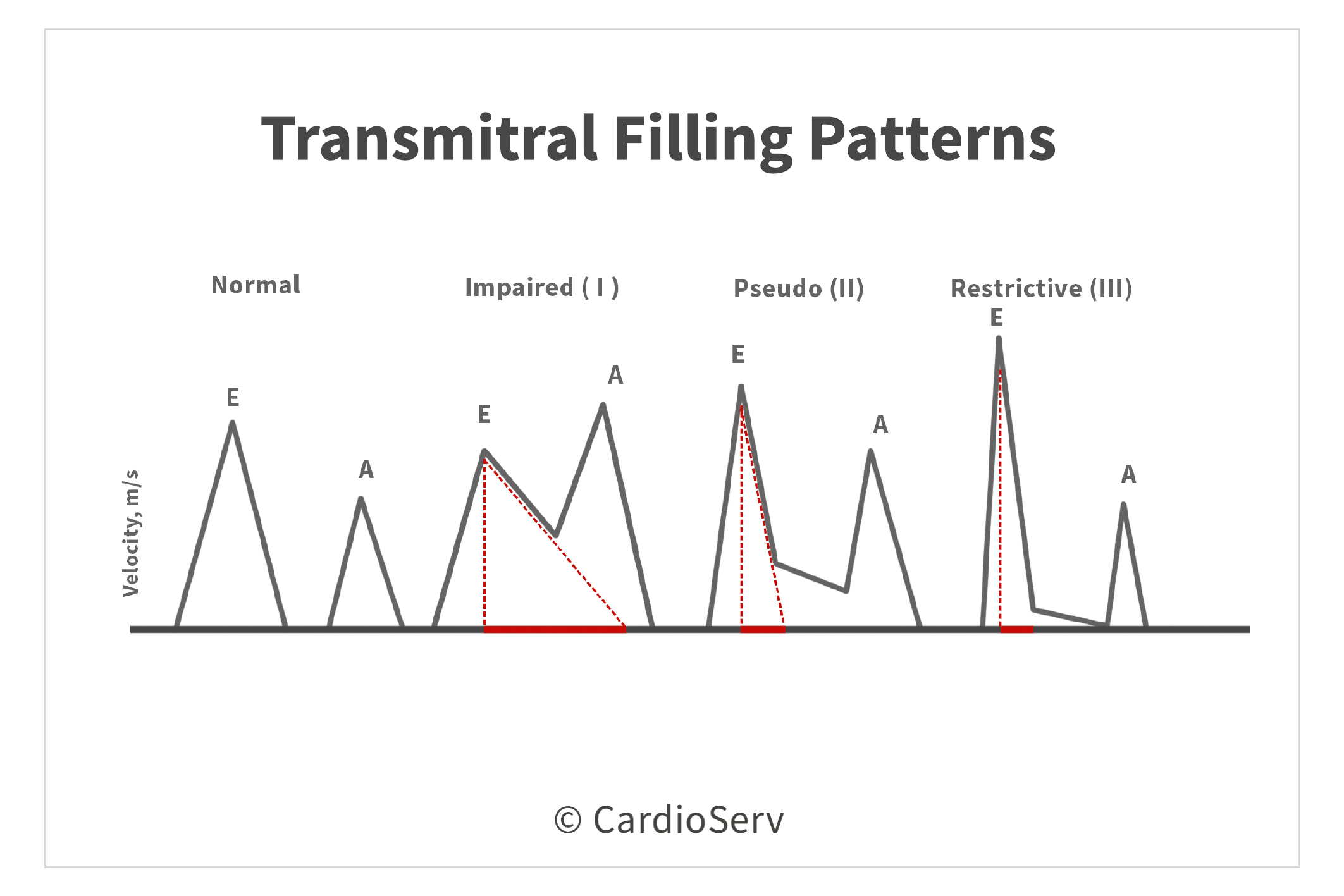 Understanding the Basics: LV Filling Patterns