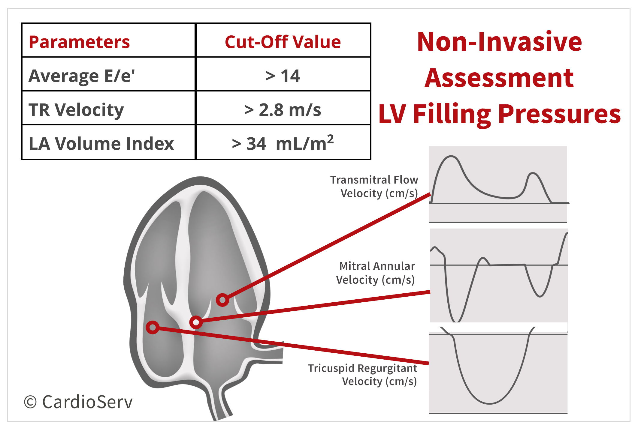 Specific Echo Parameters that Indicate Elevated LAP