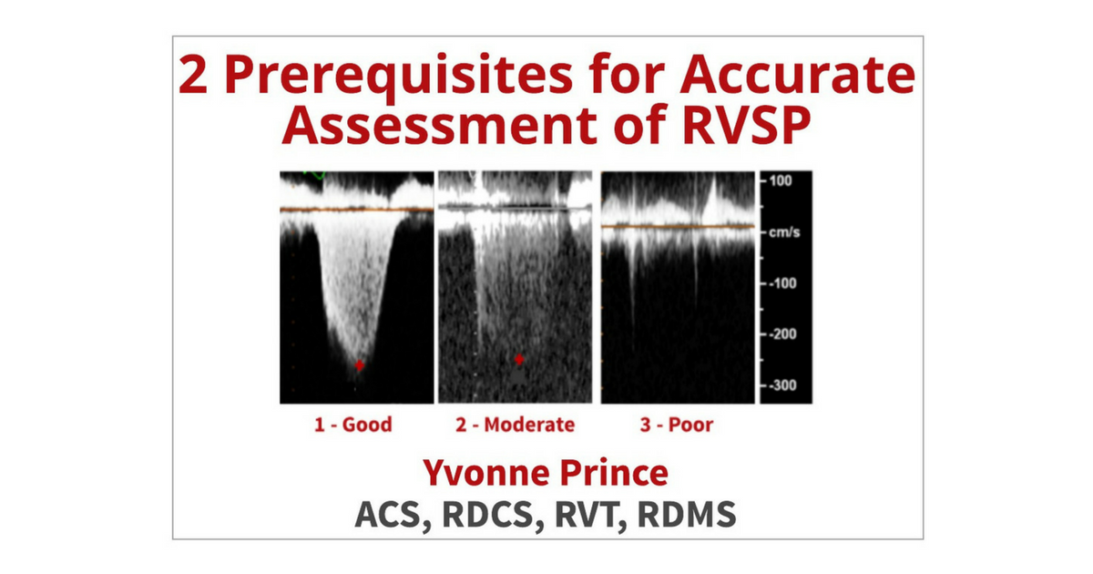 2 Ways To Properly Assess TR Jets For Accurate RVSP Calculations Cardioserv