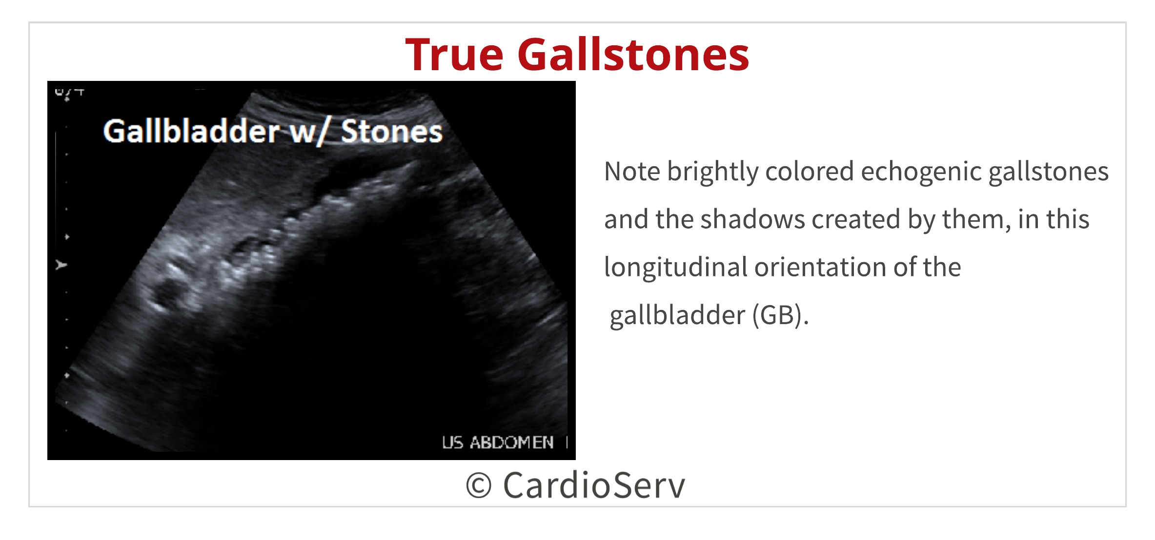 abnormal gallbladder ultrasound