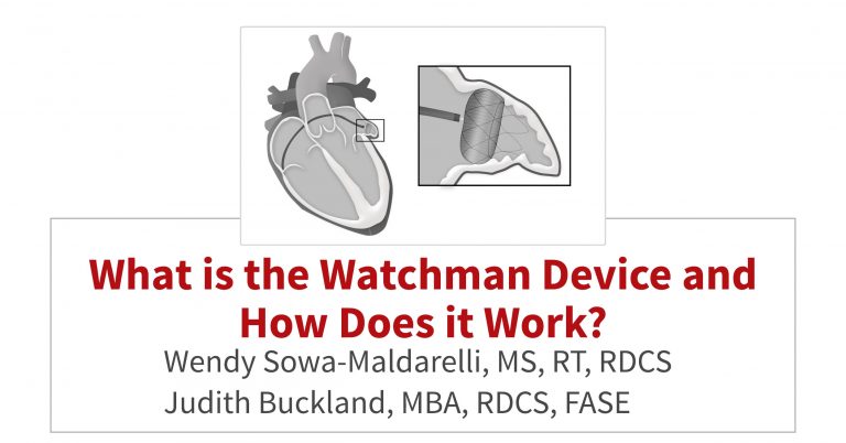 What is the Watchman Device and How Does it Work? Cardioserv